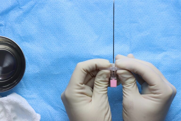 Nerve Blocks for Perioperative Analgesia