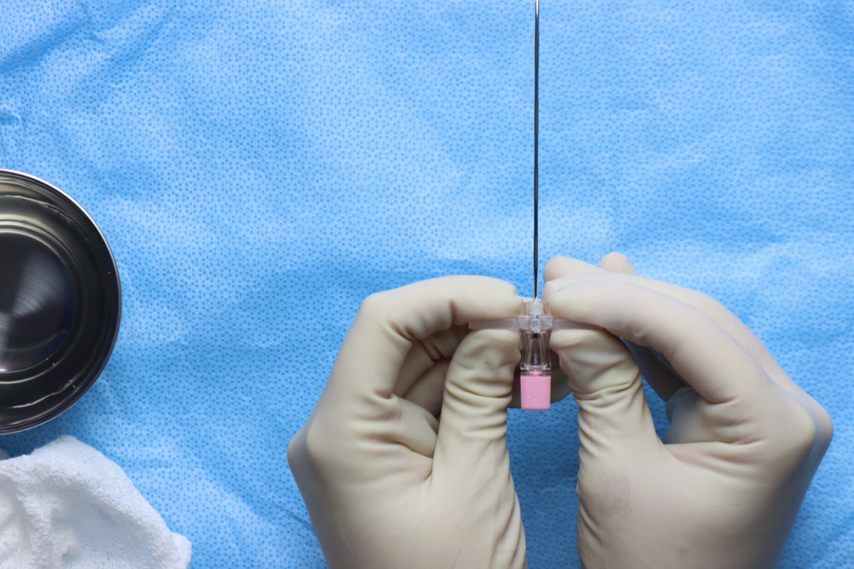Nerve Blocks for Perioperative Analgesia
